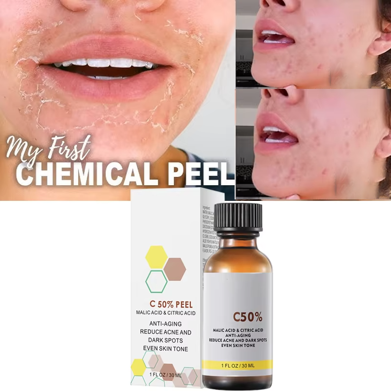 Salicylic Acid Cleanser - مع حمض الماليك وحمض الستريك للوجه
