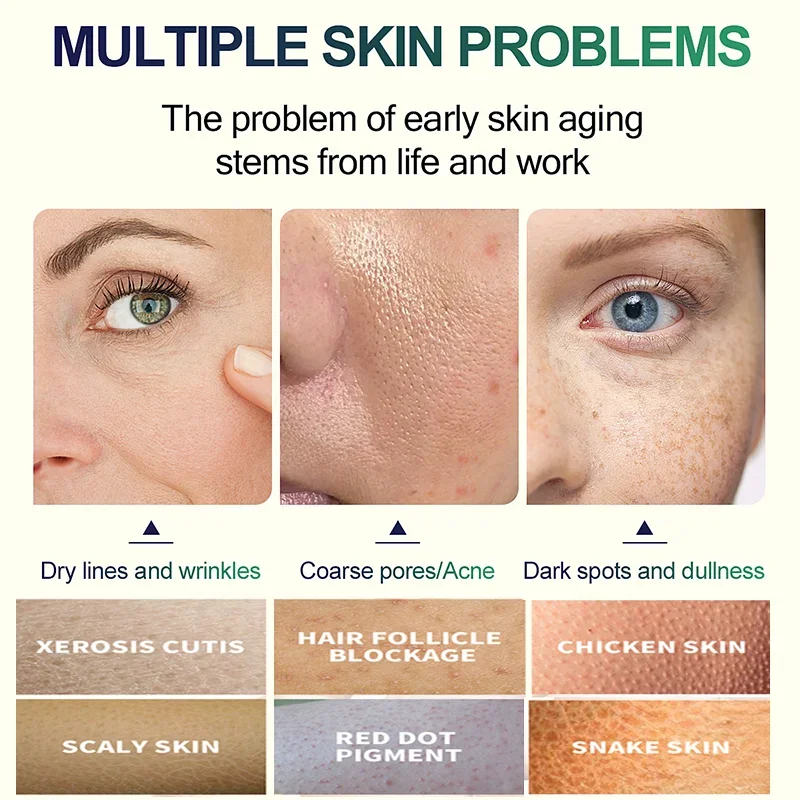 سيروم تقشير الوجه بحمض الساليس - مراجعة Salicylic Acid Cleanser وسعره