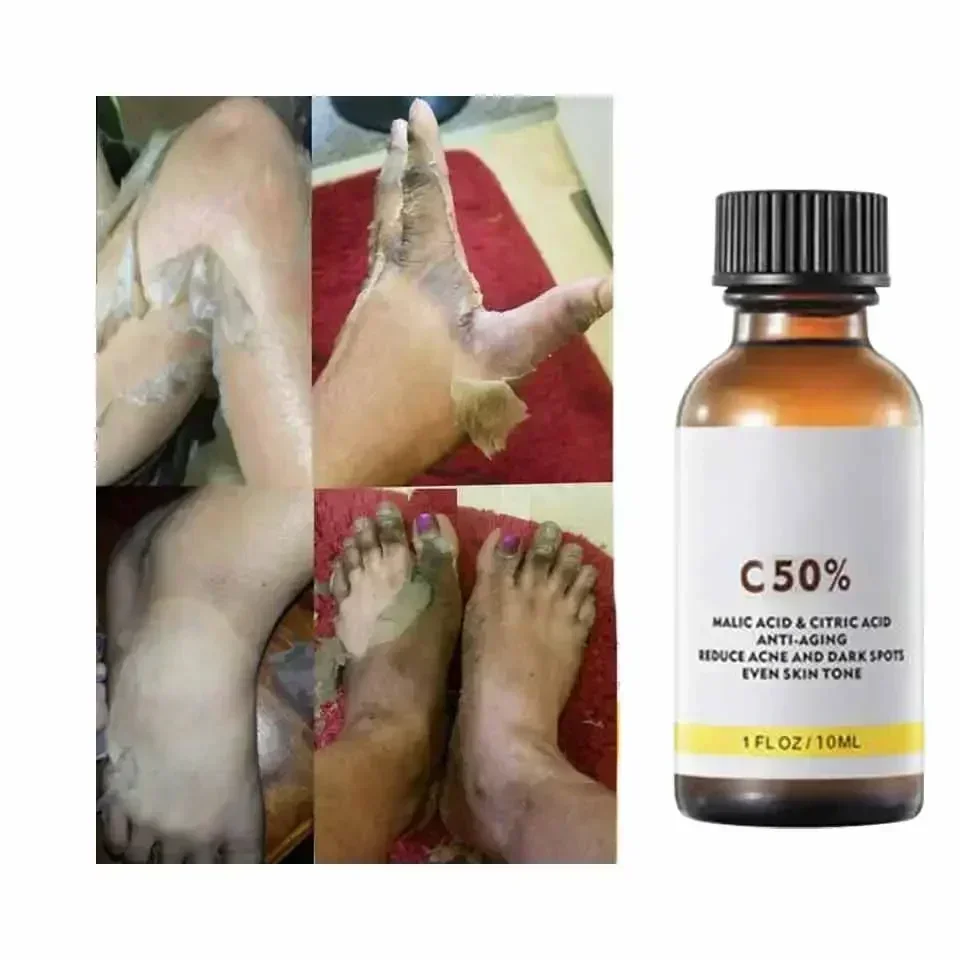 مع حمض الماليك وحمض الستريك لل - مراجعة Salicylic Acid Cleanser وسعره
